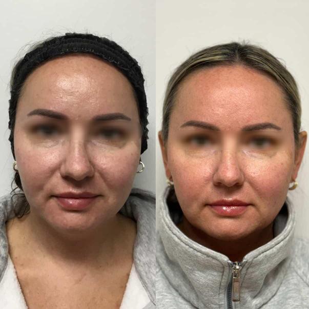 co2 mount prospect ihydrate