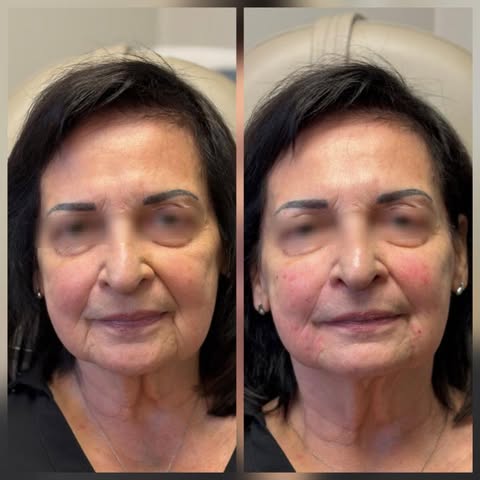 facial balancing mount prospect illinois ihydrate